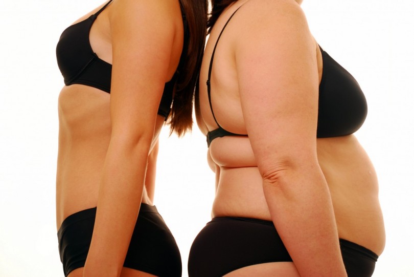 Obesidade atinge quase 20 por cento da população brasileira, mostra pesquisa