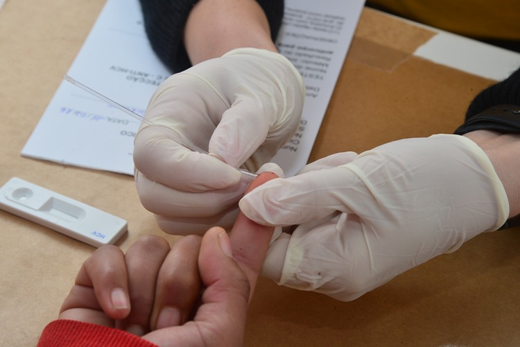 Prefeitura oferece testes rápidos de HIV nesta quinta